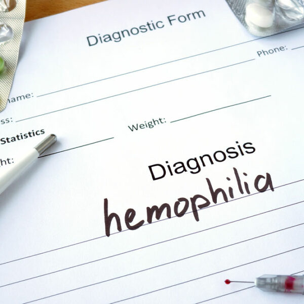Hemophilia – Symptoms, Types, and Management Options