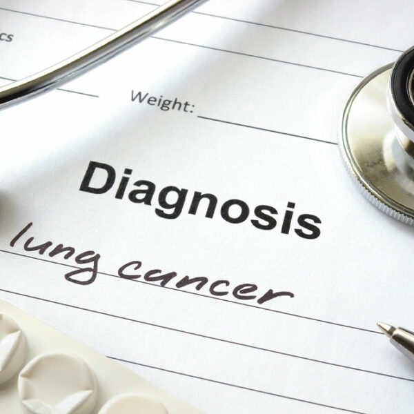 Lung Cancer – Types, Causes, and Symptoms