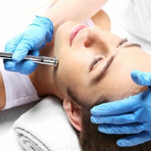 4 useful acne treatments for men