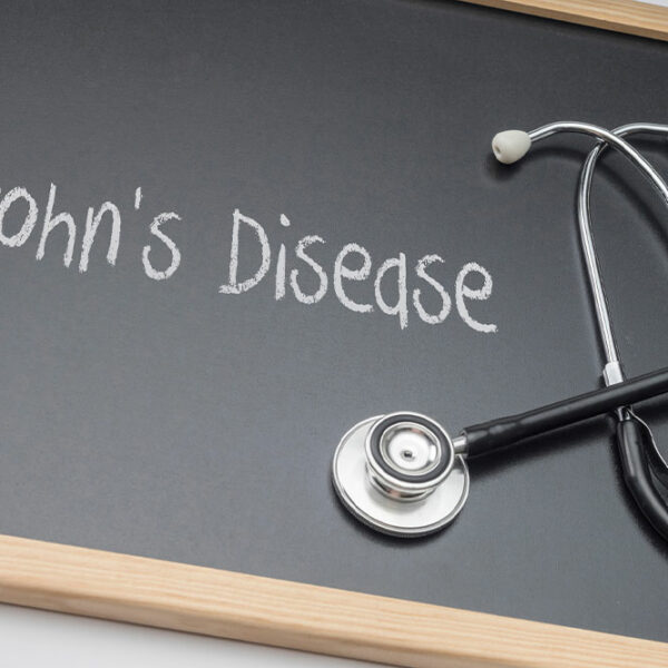 Symptoms, Types, and More About Crohn’s Disease