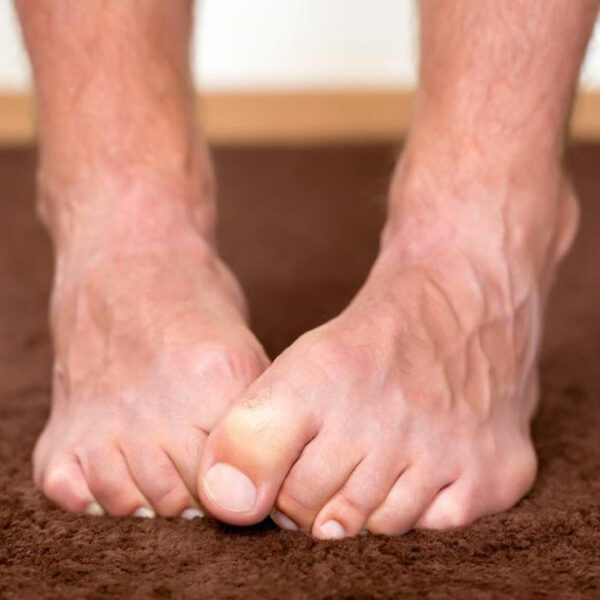 Neuropathy Foot Pain – Symptoms, Causes, Treatments and More