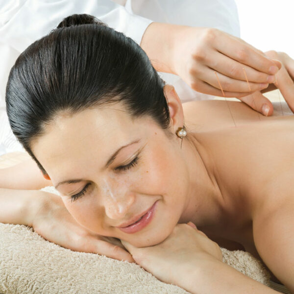 Acupuncture for Arthritis – Benefits, Cost, and More